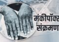 Monkeypox: दुनिया मंकीपॉक्स से सहमी, चीन ने बनाया संक्रमण से फायदा कमाने का प्लान
