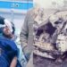 Rishabh Pant Accident