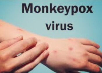monkeypox