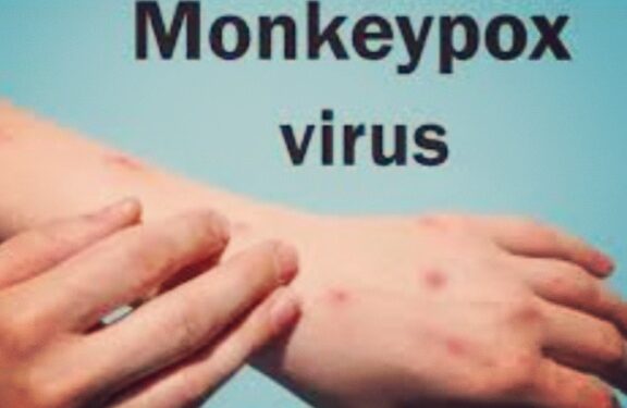monkeypox