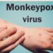 monkeypox