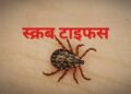 scrub typhus