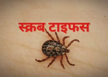 scrub typhus