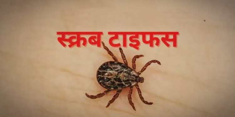 scrub typhus